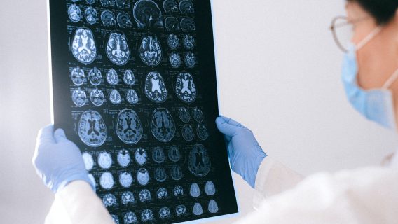 Image shows a radiologist looking at a CT scan image